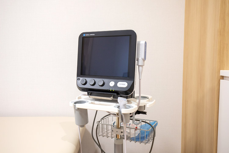 超音波診断装置