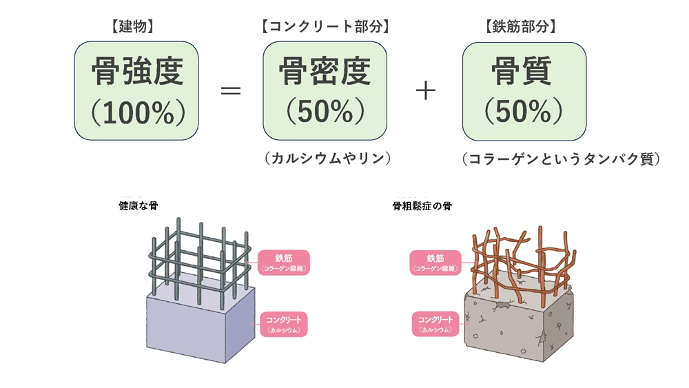 骨粗鬆症イメージ1