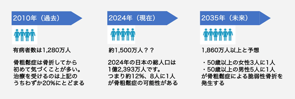 骨粗鬆症イメージ3