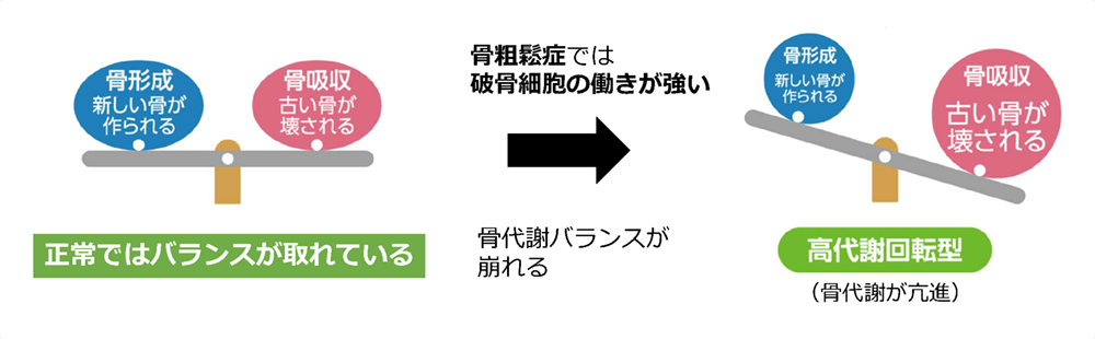 骨粗鬆症イメージ6