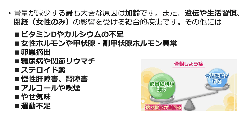 骨粗鬆症イメージ8