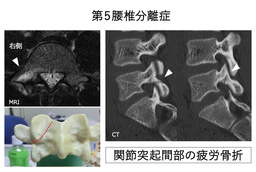 せぼね診療イメージ9