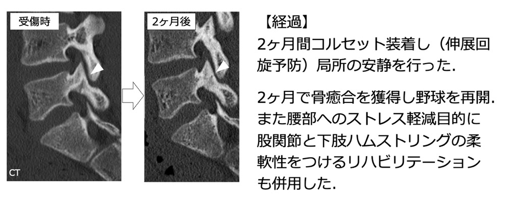 せぼね診療イメージ10
