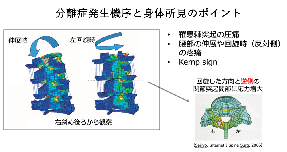 せぼね診療イメージ11