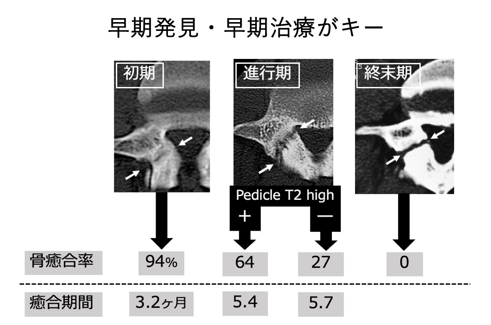 せぼね診療イメージ12