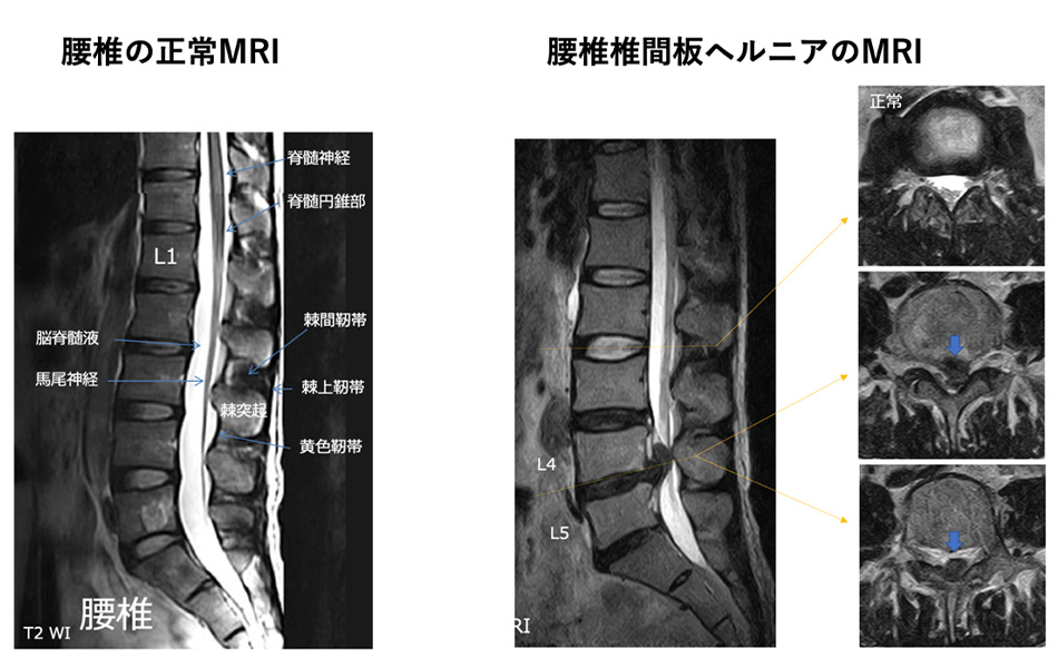 せぼね診療イメージ13