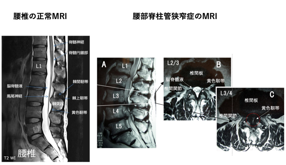 せぼね診療イメージ14