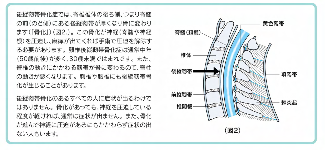 頚椎後縦靭帯骨化症イメージ1